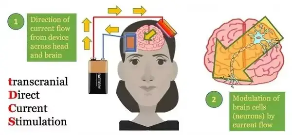 9128H Nouveau Design TDCS Médical pour Améliorer la Mémoire