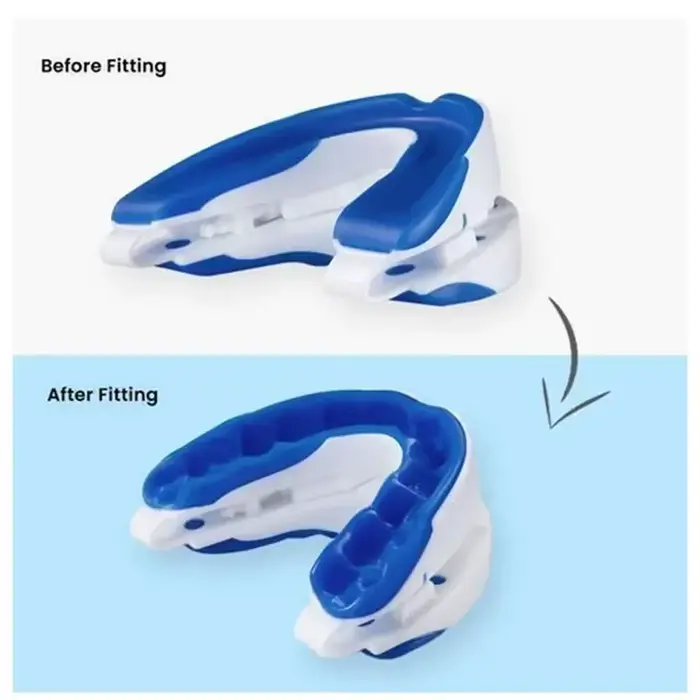 Embouchure Anti-ronflement