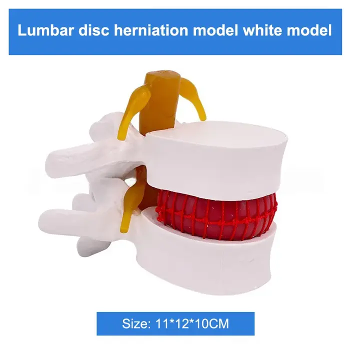 Modèle lombaire professionnel, squelette d'anatomie humaine, colonne vertébrale, hernie discale lomb