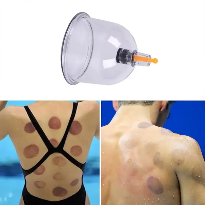 Pot de Massage à ventouses sous vide