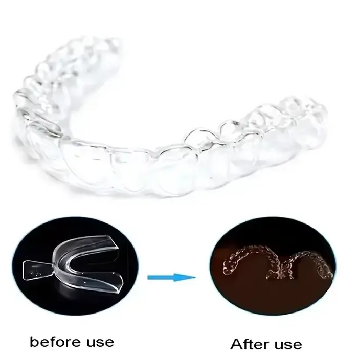 Protections nocturnes dentaires thermoplastiques