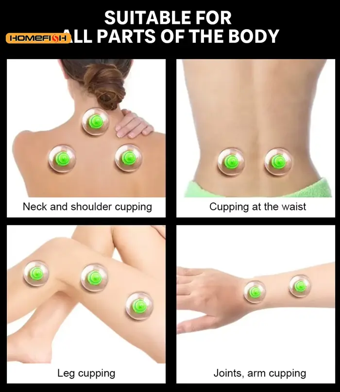 6 ventouses pour kit de massage