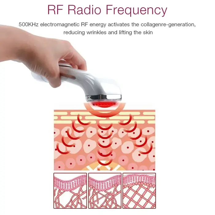 Appareil de beauté RF, radiofréquence