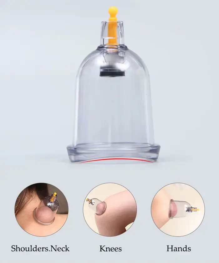 Ensemble de thérapie par ventouses médecine chinoise physiothérapie
