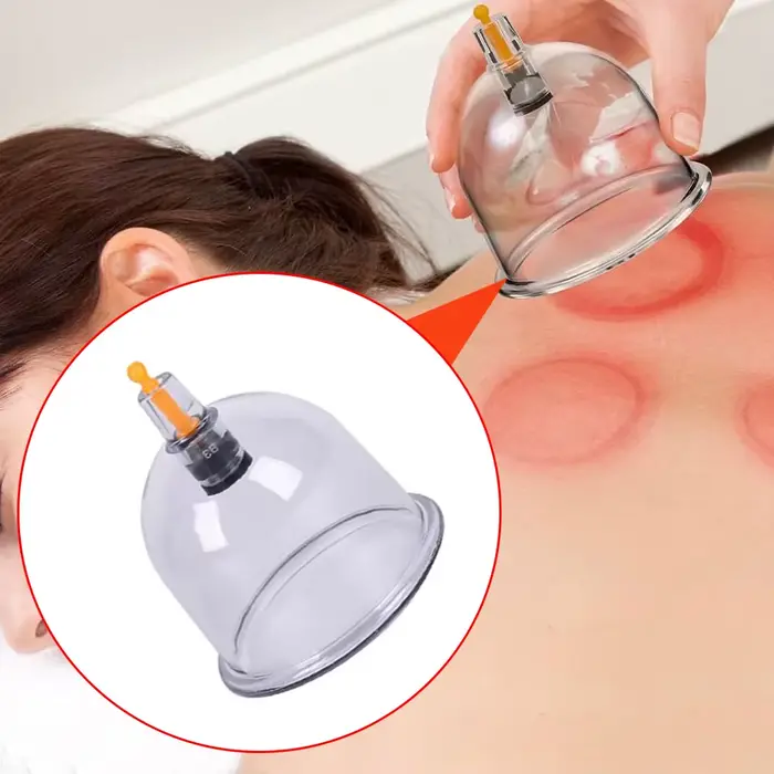 Pot de Massage à ventouses sous vide
