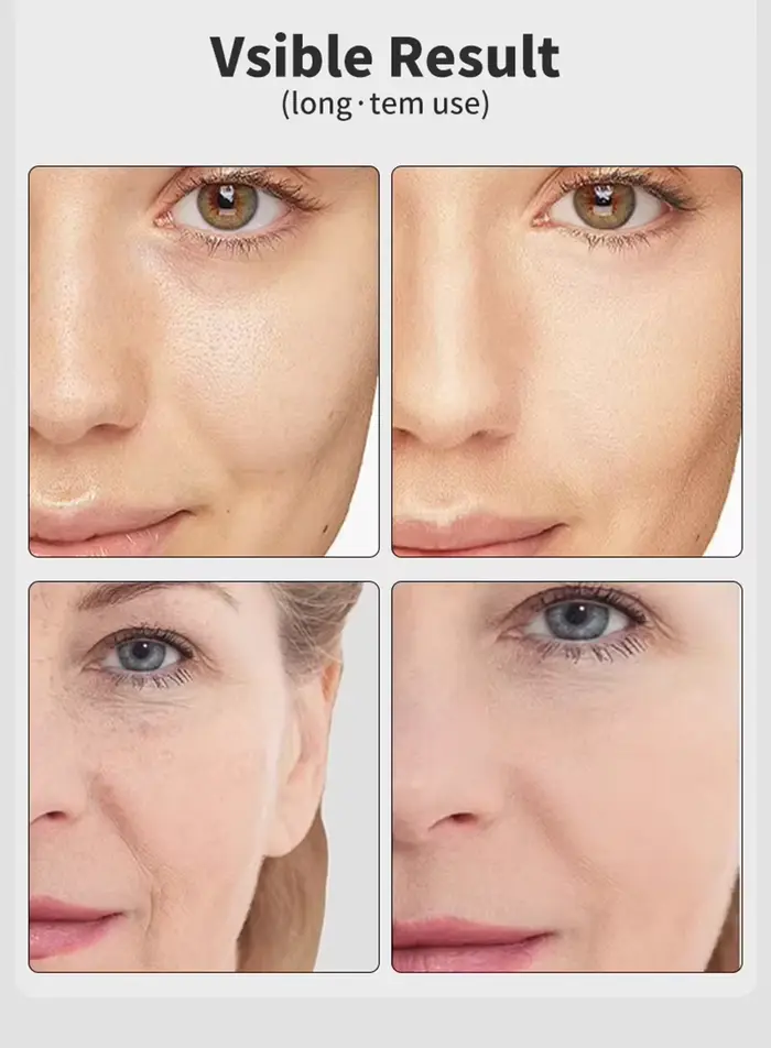 7 couleurs Age-R Booster Pro soins de la peau du visage Anti-rides dispositif de beauté EMS microcourant ascenseur