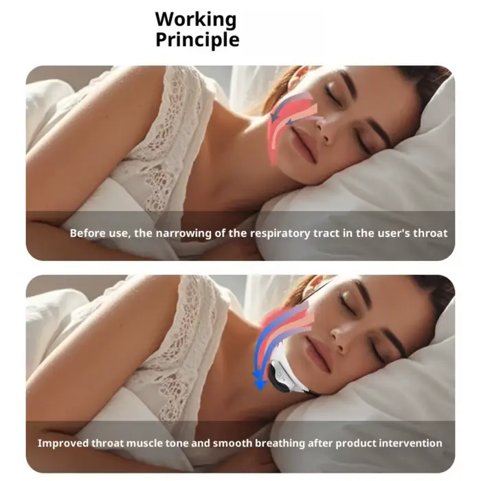 Appareil anti-ronflement pour le sommeil
